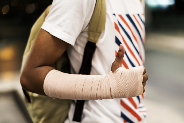 a man with a broken arm and a cast on his arm